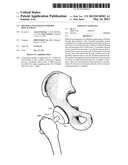 METHOD AND APPARATUS FOR HIP REPLACEMENT diagram and image