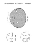 METHOD AND APPARATUS FOR HIP REPLACEMENT diagram and image