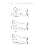 METHOD AND APPARATUS FOR HIP REPLACEMENT diagram and image