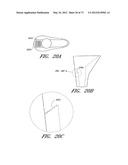 METHOD AND APPARATUS FOR HIP REPLACEMENT diagram and image