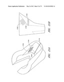 METHOD AND APPARATUS FOR HIP REPLACEMENT diagram and image