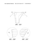 METHOD AND APPARATUS FOR HIP REPLACEMENT diagram and image