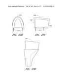 METHOD AND APPARATUS FOR HIP REPLACEMENT diagram and image