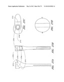 METHOD AND APPARATUS FOR HIP REPLACEMENT diagram and image