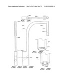 METHOD AND APPARATUS FOR HIP REPLACEMENT diagram and image