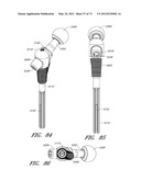 METHOD AND APPARATUS FOR HIP REPLACEMENT diagram and image