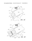 METHOD AND APPARATUS FOR HIP REPLACEMENT diagram and image