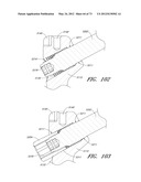 METHOD AND APPARATUS FOR HIP REPLACEMENT diagram and image