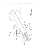 METHOD AND APPARATUS FOR HIP REPLACEMENT diagram and image