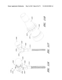 METHOD AND APPARATUS FOR HIP REPLACEMENT diagram and image