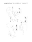 METHOD AND APPARATUS FOR HIP REPLACEMENT diagram and image