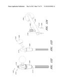 METHOD AND APPARATUS FOR HIP REPLACEMENT diagram and image