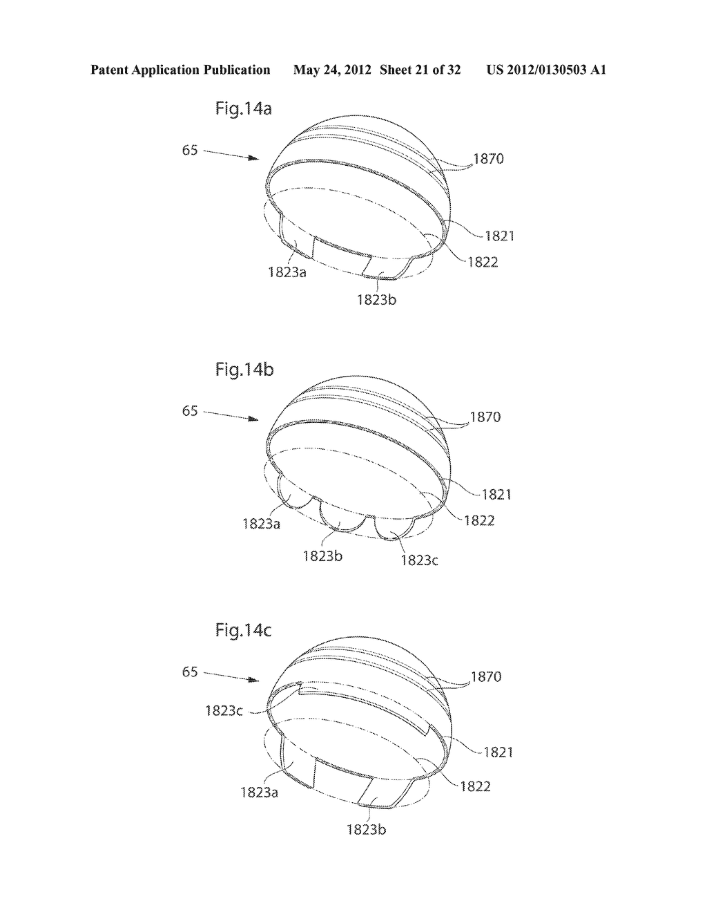 HIP JOINT DEVICE - diagram, schematic, and image 22