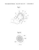 HIP JOINT DEVICE, SYSTEM AND METHOD diagram and image