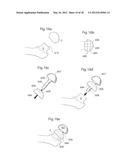HIP JOINT DEVICE, SYSTEM AND METHOD diagram and image