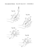 HIP JOINT DEVICE, SYSTEM AND METHOD diagram and image