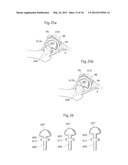 HIP JOINT DEVICE, SYSTEM AND METHOD diagram and image