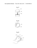 HIP JOINT DEVICE, SYSTEM AND METHOD diagram and image