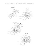 HIP JOINT DEVICE, SYSTEM AND METHOD diagram and image