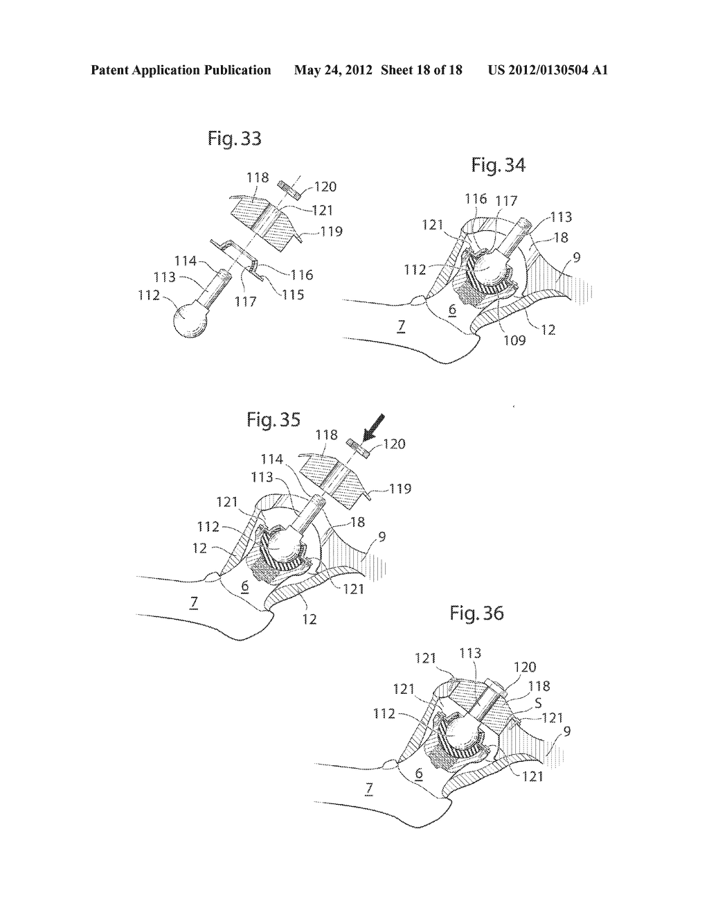 HIP JOINT DEVICE, SYSTEM AND METHOD - diagram, schematic, and image 19