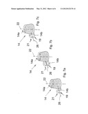 STARTING DEVICE FOR AN INTERNAL COMBUSTION ENGINE diagram and image