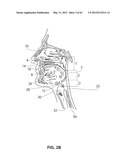 SYSTEMS AND METHODS FOR TREATMENT OF SLEEP APNEA diagram and image