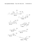 SYSTEMS AND METHODS FOR TREATMENT OF SLEEP APNEA diagram and image