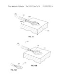 SYSTEMS AND METHODS FOR TREATMENT OF SLEEP APNEA diagram and image