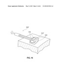 SYSTEMS AND METHODS FOR TREATMENT OF SLEEP APNEA diagram and image