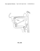 SYSTEMS AND METHODS FOR TREATMENT OF SLEEP APNEA diagram and image