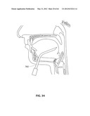 SYSTEMS AND METHODS FOR TREATMENT OF SLEEP APNEA diagram and image