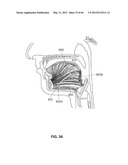 SYSTEMS AND METHODS FOR TREATMENT OF SLEEP APNEA diagram and image