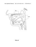 SYSTEMS AND METHODS FOR TREATMENT OF SLEEP APNEA diagram and image