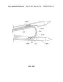 SYSTEMS AND METHODS FOR TREATMENT OF SLEEP APNEA diagram and image