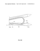 SYSTEMS AND METHODS FOR TREATMENT OF SLEEP APNEA diagram and image