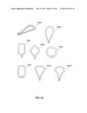 SYSTEMS AND METHODS FOR TREATMENT OF SLEEP APNEA diagram and image