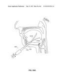 SYSTEMS AND METHODS FOR TREATMENT OF SLEEP APNEA diagram and image