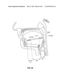 SYSTEMS AND METHODS FOR TREATMENT OF SLEEP APNEA diagram and image