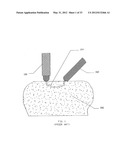 Pressure Pulse Fracturing System diagram and image