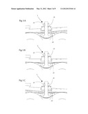 ROLLER SKATE diagram and image