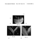 TEAR FILM AND TEAR MENISCUS DYNAMICS WITH TIME-LAPSE OPTICAL COHERENCE     TOMOGRAPHY diagram and image