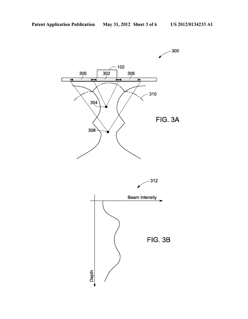 SYSTEMS AND METHODS FOR ACOUSTIC RADIATION FORCE IMAGING WITH ENHANCED     PERFORMANCE - diagram, schematic, and image 04