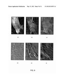 Spatio-Temporal Analysis for Automatic Contrast Injection Detection on     Angiography During Trans-Catheter Aortic Valve Implantation diagram and image