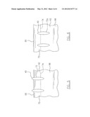 ENGINE CASE WITH WASH SYSTEM diagram and image