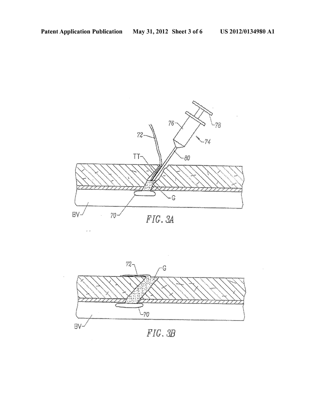 FRAGMENTED POLYMERIC COMPOSITIONS AND METHODS FOR THEIR USE - diagram, schematic, and image 04