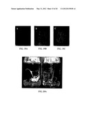 EXPRESSION OF PROTECTIVE ANTIGENS IN TRANSGENIC CHLOROPLASTS AND THE     PRODUCTION OF IMPROVED VACCINES diagram and image