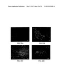 EXPRESSION OF PROTECTIVE ANTIGENS IN TRANSGENIC CHLOROPLASTS AND THE     PRODUCTION OF IMPROVED VACCINES diagram and image