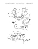 Manufacturing Method Of A Guiding Template For Dental Implantology,     Guiding Template Manufactured Thereby And Reference Device For The     Execution Of Such Method diagram and image