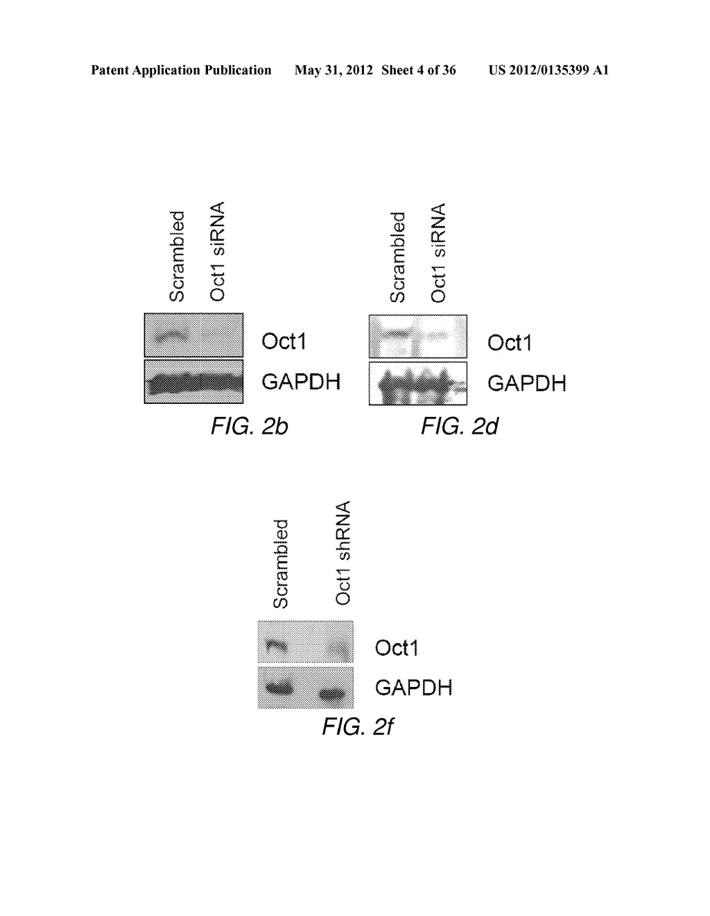 CANCER BIOMARKER AND METHODS OF USING THEREOF - diagram, schematic, and image 05