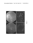 LOW-PRESSURE BIOLISTIC BARRELS diagram and image